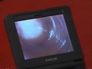 Extremely Hairy Japanese damsel Anus Fuck